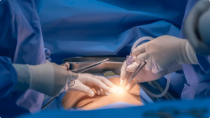 Best Laparoscopic Surgeon in Rajender Nagar