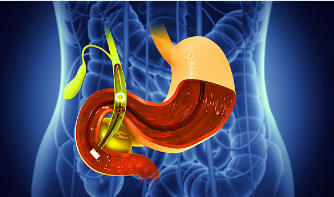 Best Gallbladder Surgeon in Kaushambi