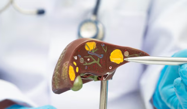 Best Gallbladder stone treatment in Rajendra Nagar