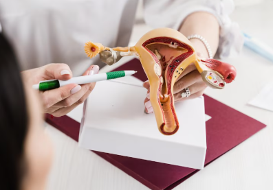 Best Ovarian cyst treatment in Rajendra Nagar