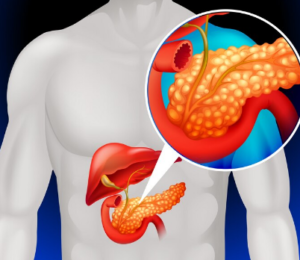 Best Pseudopancreatic Cyst Centre in Rajendra Nagar
