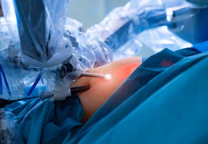 Best Doctor for Appendectomy Surgery in Rajendra Nagar