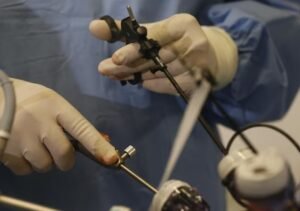 Best Diagnostic Laparoscopic Surgery in Sahibabad