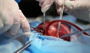 Best Laparoscopic Hysterectomy in Rajendra Nagar