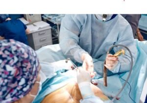 Best Diagnostic Laparoscopy Treatment in Shalimar Bagh