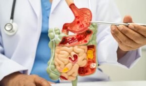 Best Appendix Treatment in Indirapuram