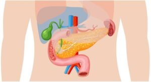 Best Gallbladder Doctor in Indirapuram