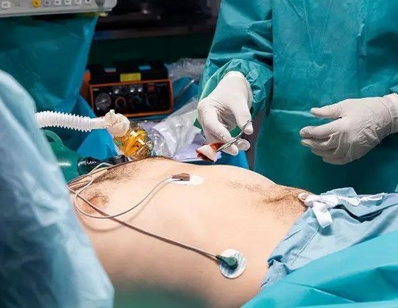 Best Appendix Surgeon in Indirapuram